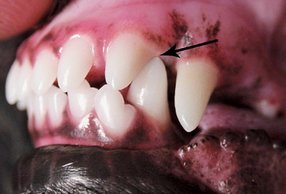 Malocclusion of lower canine and upper incisor